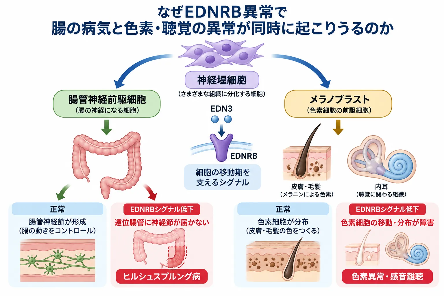 EDNRBシグナルが神経堤由来の腸管神経前駆細胞とメラノブラストの移動を支え、シグナル低下によってヒルシュスプルング病や色素異常・感音難聴につながる仕組みを示す模式図