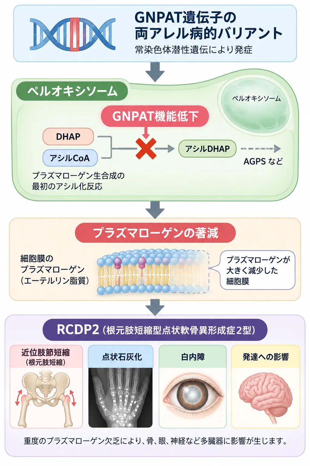 GNPAT遺伝子の両アレル病的バリアントによりペルオキシソーム内のGNPAT機能が低下し、プラズマローゲン生合成が障害されてRCDP2を発症する機序を示した模式図
