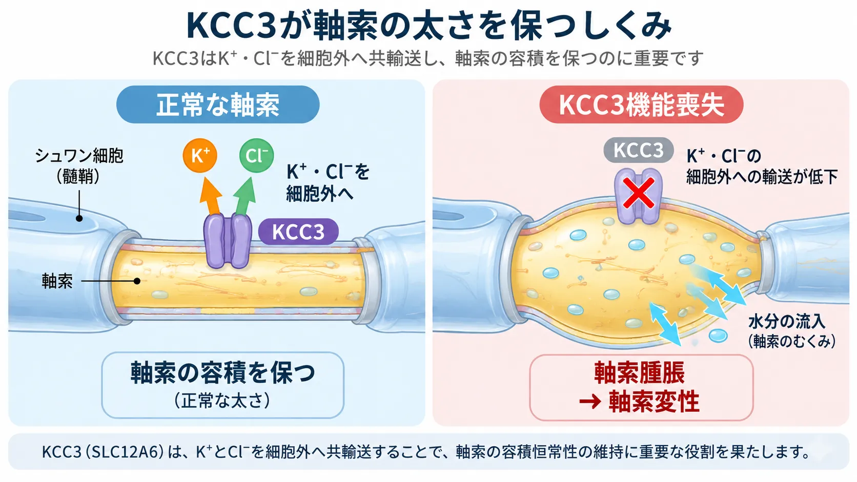 KCC3による軸索容積恒常性の模式図。正常ではKCC3がカリウムイオンと塩化物イオンを細胞外へ共輸送して軸索の容積を保つが、SLC12A6の機能喪失によりKCC3機能が低下すると容積調節が障害され、軸索腫脹から軸索変性へ進む