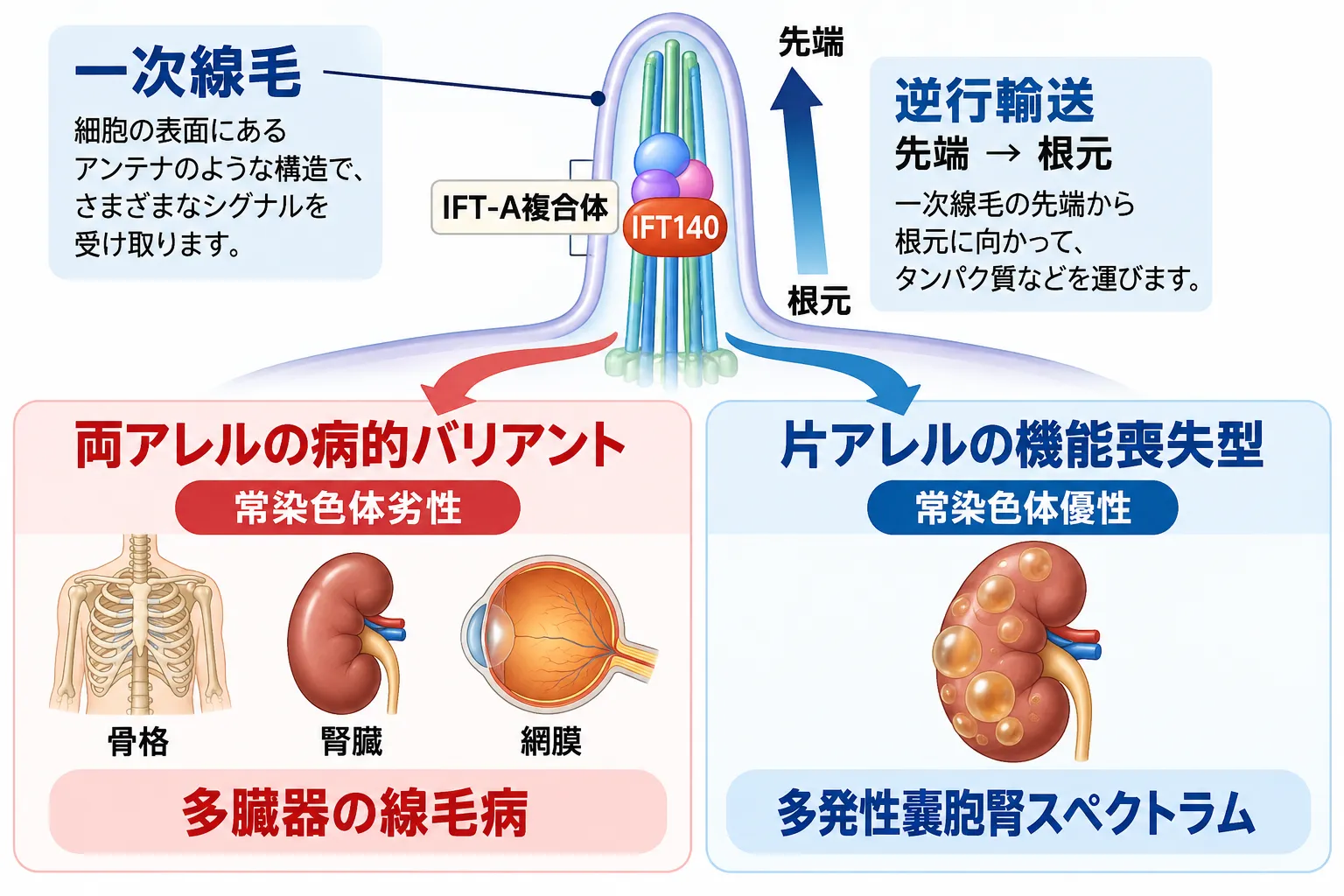 IFT140が一次線毛のIFT-A複合体で逆行輸送に関与し、両アレルの病的バリアントでは骨格・腎臓・網膜に及ぶ多臓器の線毛病、片アレルの機能喪失型バリアントでは多発性嚢胞腎スペクトラムにつながる遺伝形式と表現型の違いを示す模式図