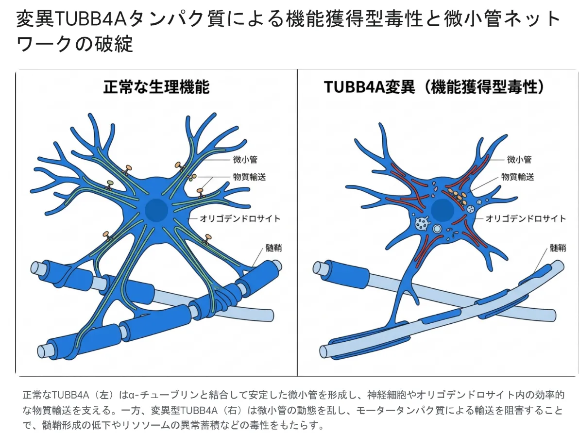正常な細胞と、TUBB4A変異による機能獲得型毒性を左右で比較した図。左「正常な生理機能」では、TUBB4Aがα-チューブリンと結合して安定した微小管(緑)を形成し、その上をモータータンパク質が動いて物質輸送を行い、オリゴデンドロサイトが軸索に厚い髄鞘(ミエリン)を巻いている。右「TUBB4A変異(機能獲得型毒性)」では、微小管が乱れて短く不規則になり(赤)、物質輸送が滞ってリソソームなどが異常に蓄積し、細胞が萎縮して、軸索を包む髄鞘が薄くなっている様子を示す。