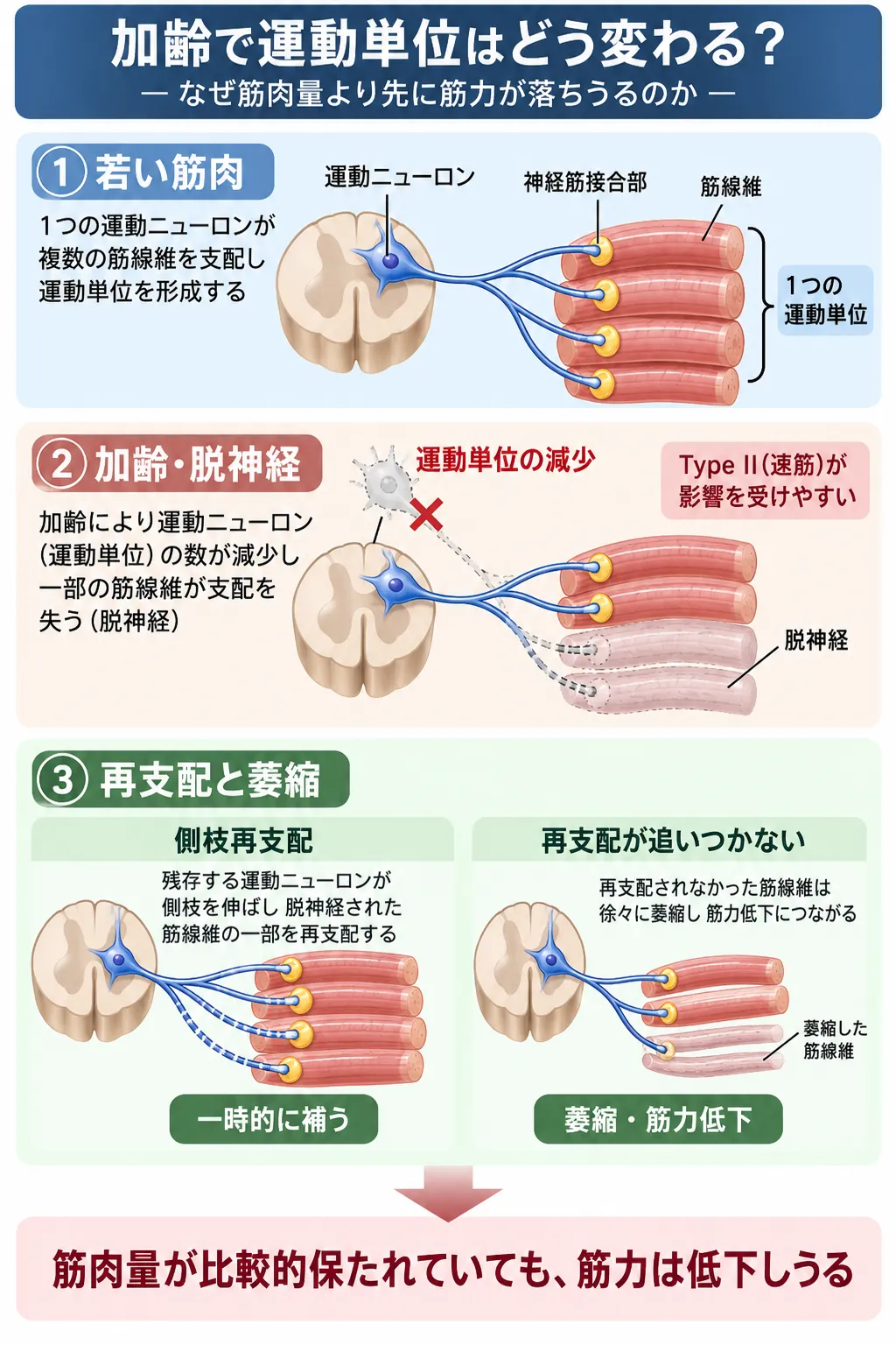 加齢により運動ニューロンと運動単位が減少し、筋線維の脱神経、側枝再支配、再支配が追いつかない筋線維の萎縮を経て、筋肉量が比較的保たれていても筋力が低下するサルコペニアの神経筋機序を示す模式図