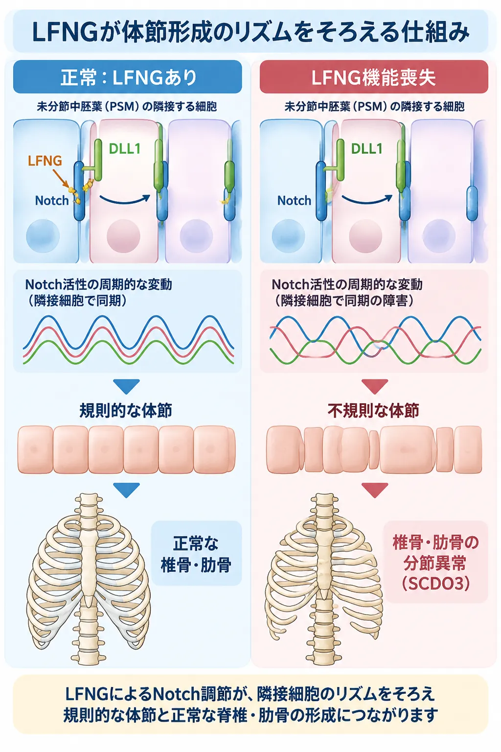 LFNGがNotchシグナルを調節して未分節中胚葉の隣接細胞の体節形成リズムを同期させ、規則的な体節から正常な椎骨・肋骨が形成される一方、LFNG機能喪失では同期が乱れて不規則な体節となり、脊椎肋骨異骨症3型（SCDO3）の椎骨・肋骨分節異常につながる仕組みを比較した模式図