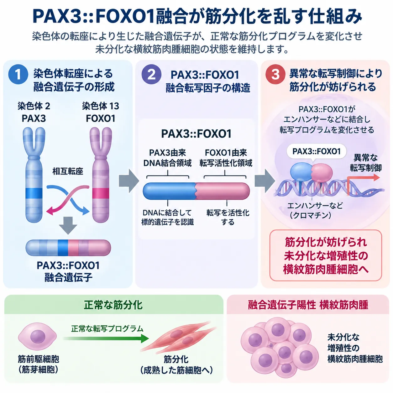 PAX3遺伝子とFOXO1遺伝子の染色体転座によりPAX3::FOXO1融合遺伝子が形成され、融合転写因子による異常な転写制御が筋分化を妨げ、未分化で増殖性の横紋筋肉腫細胞が維持される仕組みを示す模式図