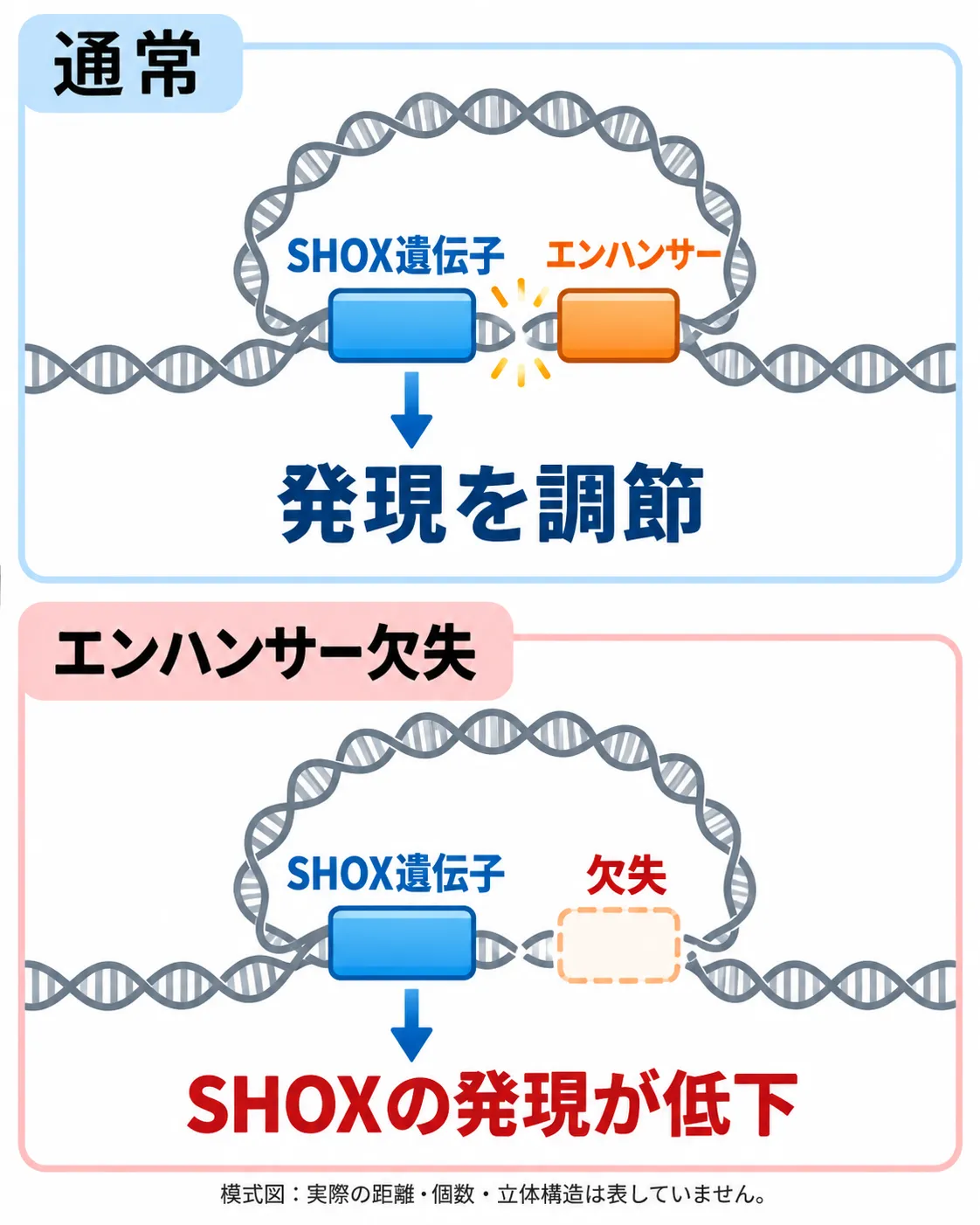 SHOX遺伝子から離れたエンハンサーが欠失すると、遺伝子本体が残っていてもSHOXの発現が低下することを示す模式図