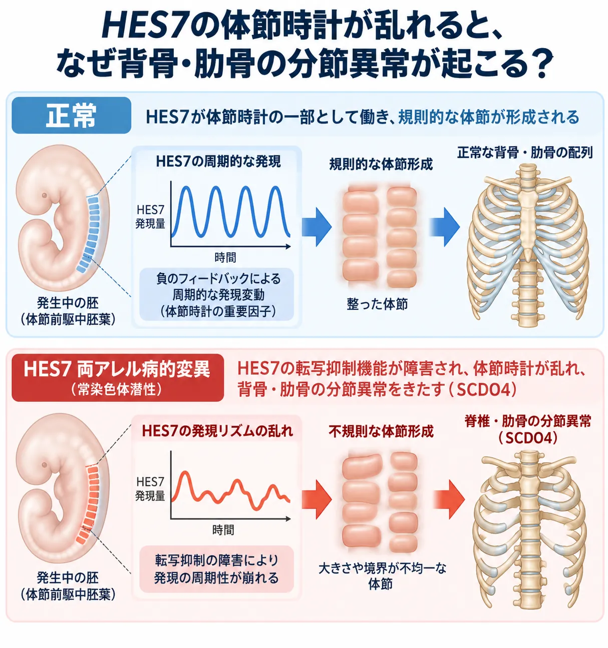 HES7の周期的な発現による正常な体節形成と、HES7両アレル病的変異による体節時計の乱れから脊椎・肋骨の分節異常を伴う脊椎肋骨異形成症4型（SCDO4）に至る仕組みを比較した模式図