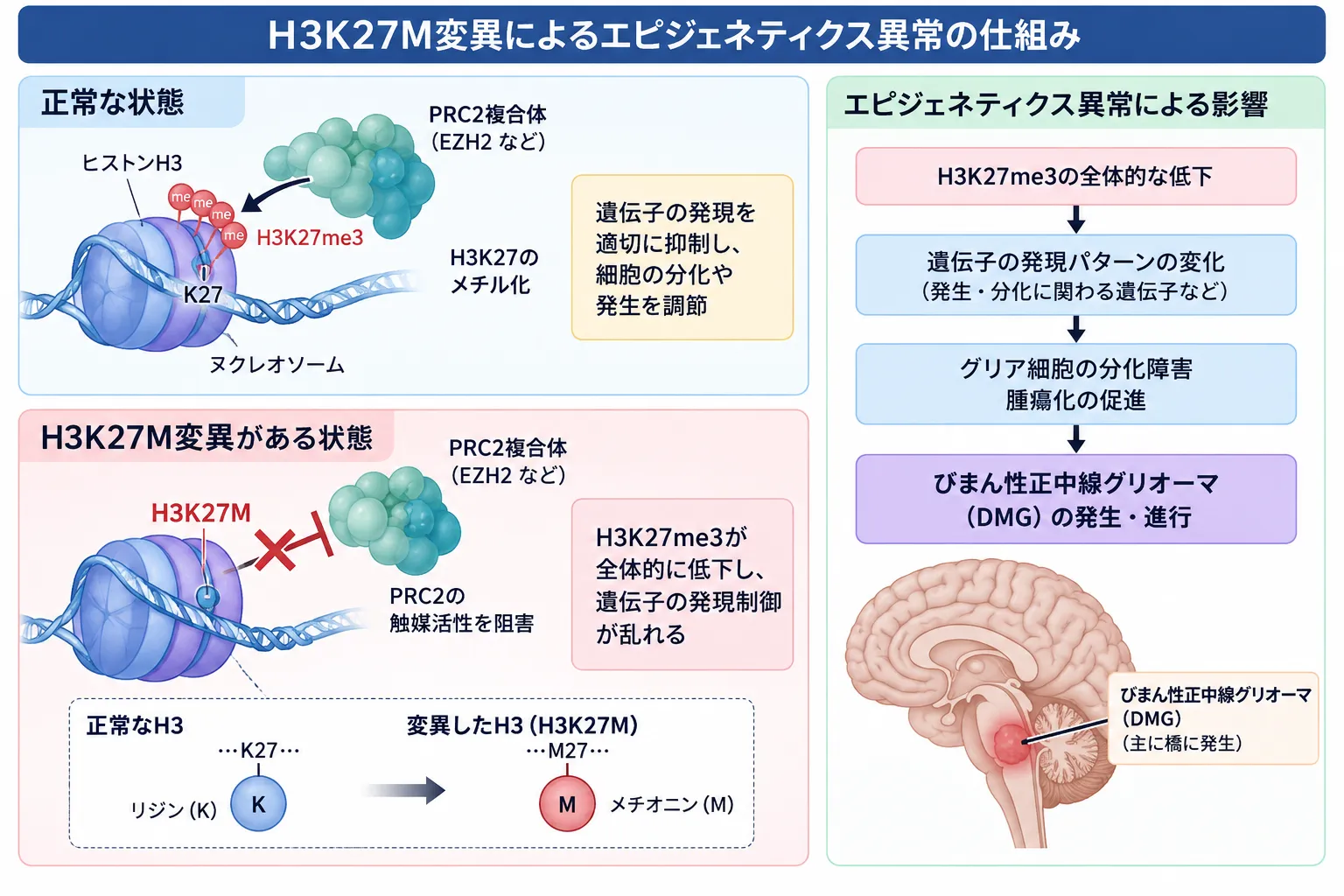 H3K27M変異によるPRC2活性阻害とH3K27me3低下、遺伝子発現異常からびまん性正中グリオーマ発生に至る仕組みを示す模式図