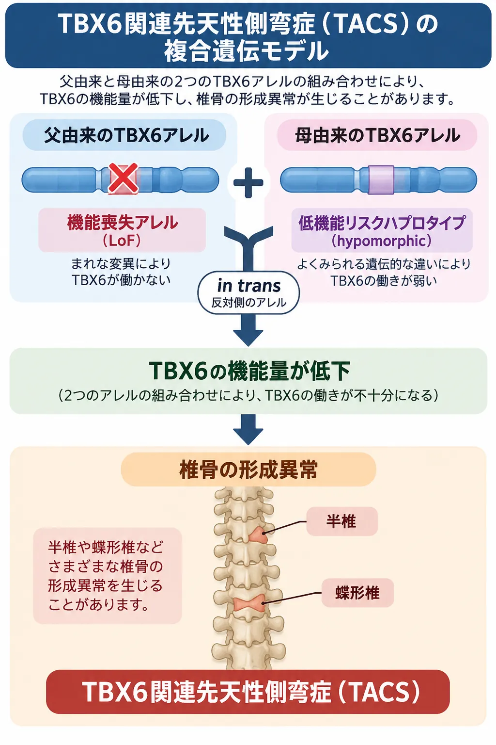 TBX6関連先天性側弯症(TACS)の複合遺伝モデル TBX6の機能喪失アレルと低機能リスクハプロタイプが反対側のアレルに存在するとTBX6機能量が低下し、半椎などの椎骨形成異常を介してTBX6関連先天性側弯症(TACS)につながる複合遺伝モデル