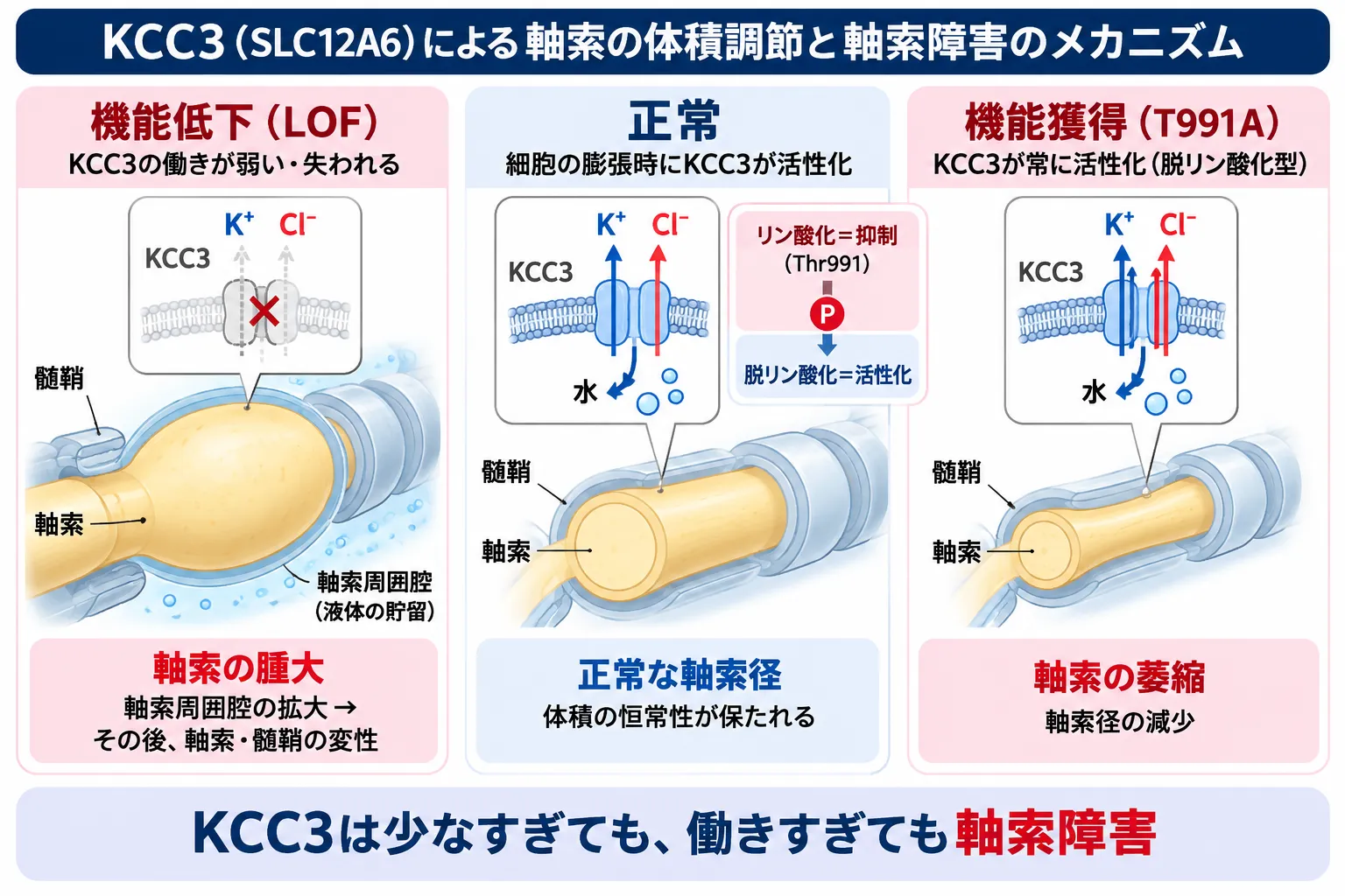 KCC3(SLC12A6)の機能低下ではK⁺・Cl⁻排出が低下して軸索と軸索周囲腔が腫大し、正常では細胞膨張時のKCC3活性化により軸索径が保たれる一方、T991A機能獲得変異ではKCC3が恒常的に活性化して軸索径が減少することを比較した模式図