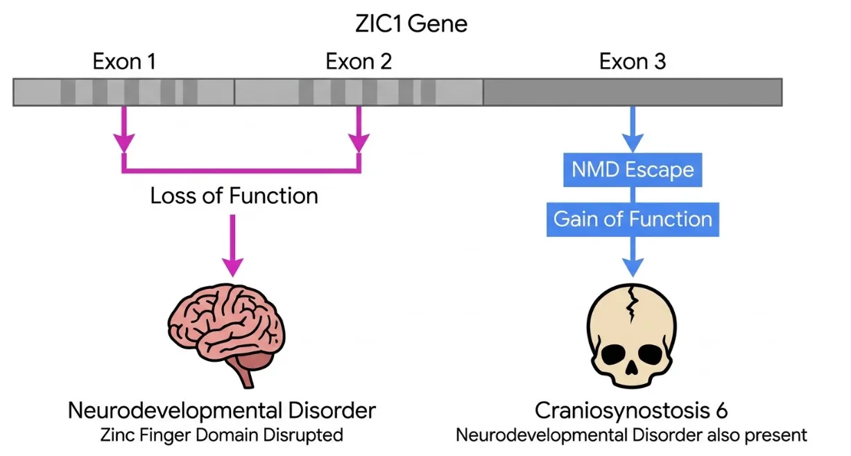 ZIC1遺伝子を横長のバーで示し、左からエクソン1・エクソン2・エクソン3を並べた模式図。エクソン1とエクソン2に起こる変異は2本のピンクの矢印で下向きに集まり「機能喪失（Loss of Function）」となり、脳のイラストへ矢印が伸びて「神経発達症（ジンクフィンガードメインの障害）」を引き起こすことを示す。一方、最終エクソンであるエクソン3に起こる変異は青い矢印で下向きに進み、「NMD回避（NMD Escape）」を経て「機能獲得（Gain of Function）」となり、頭蓋骨のイラストへ矢印が伸びて「頭蓋骨縫合早期癒合症6型（Craniosynostosis 6）※神経発達症も併発しうる」を引き起こすことを示す。同じZIC1遺伝子でも、変異が起こるエクソンの位置と変異の性質によって、正反対のメカニズムで異なる病気になることを表した図。
