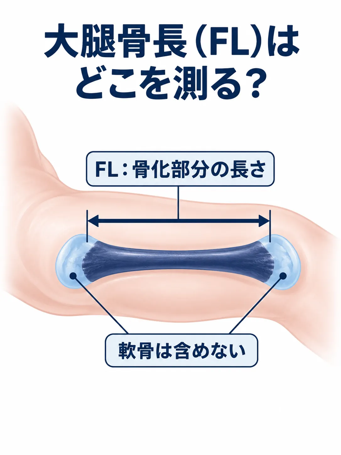 胎児の大腿骨長FLは、大腿骨の骨化部分の両端を測り、両端の軟骨は含めないことを示す模式図
