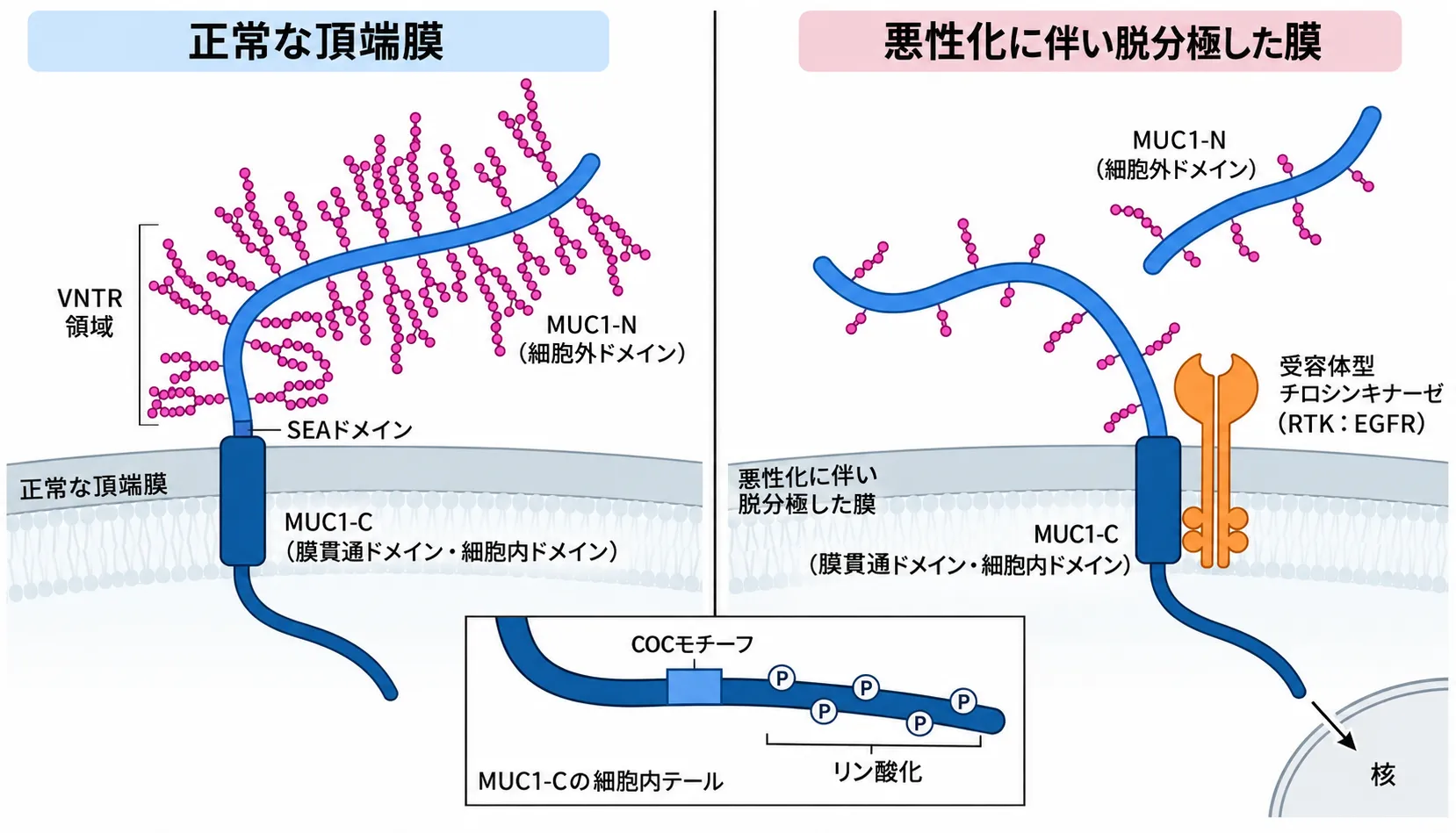 正常な上皮細胞とがん細胞におけるMUC1の構造の違いを示す図。左の正常上皮では、MUC1が細胞膜の頂端面にきちんと並び、糖鎖（VNTR領域）で装飾されたMUC1-Nが外側に突き出して粘液バリアを形成し、SEAドメインを介してMUC1-Cと結合している。右のがん細胞では細胞極性が失われ、MUC1-Nが脱落し、露出したMUC1-CがEGFRなどの受容体チロシンキナーゼ（RTK）と結合して核へ移動する。中央下の拡大図は、MUC1-Cの細胞内テールにあるCQCモチーフとリン酸化部位を示す。