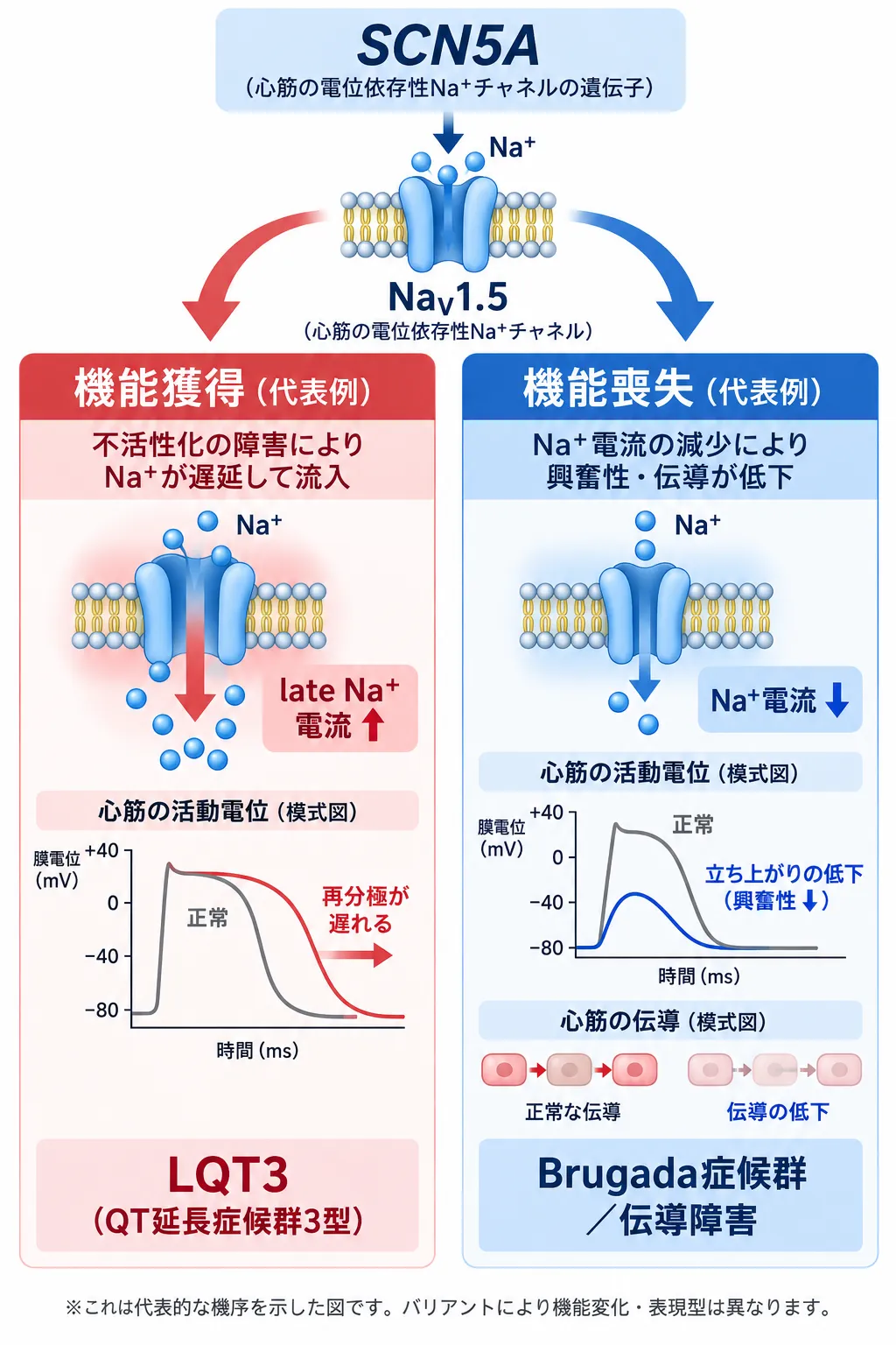 SCN5Aがコードする心筋NaV1.5チャネルで、機能獲得により遅延Na⁺電流が増加して再分極が遅れLQT3につながる機序と、機能喪失によりNa⁺電流が減少して興奮性・伝導が低下しBrugada症候群や伝導障害につながる機序を比較した模式図