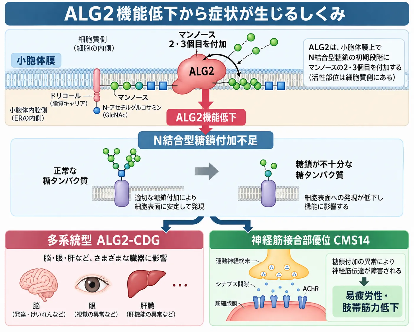 ALG2が小胞体膜でN結合型糖鎖前駆体にマンノースを付加し、ALG2機能低下による糖鎖付加不足から多系統型ALG2-CDGと神経筋接合部優位のCMS14が生じる仕組みを示した模式図