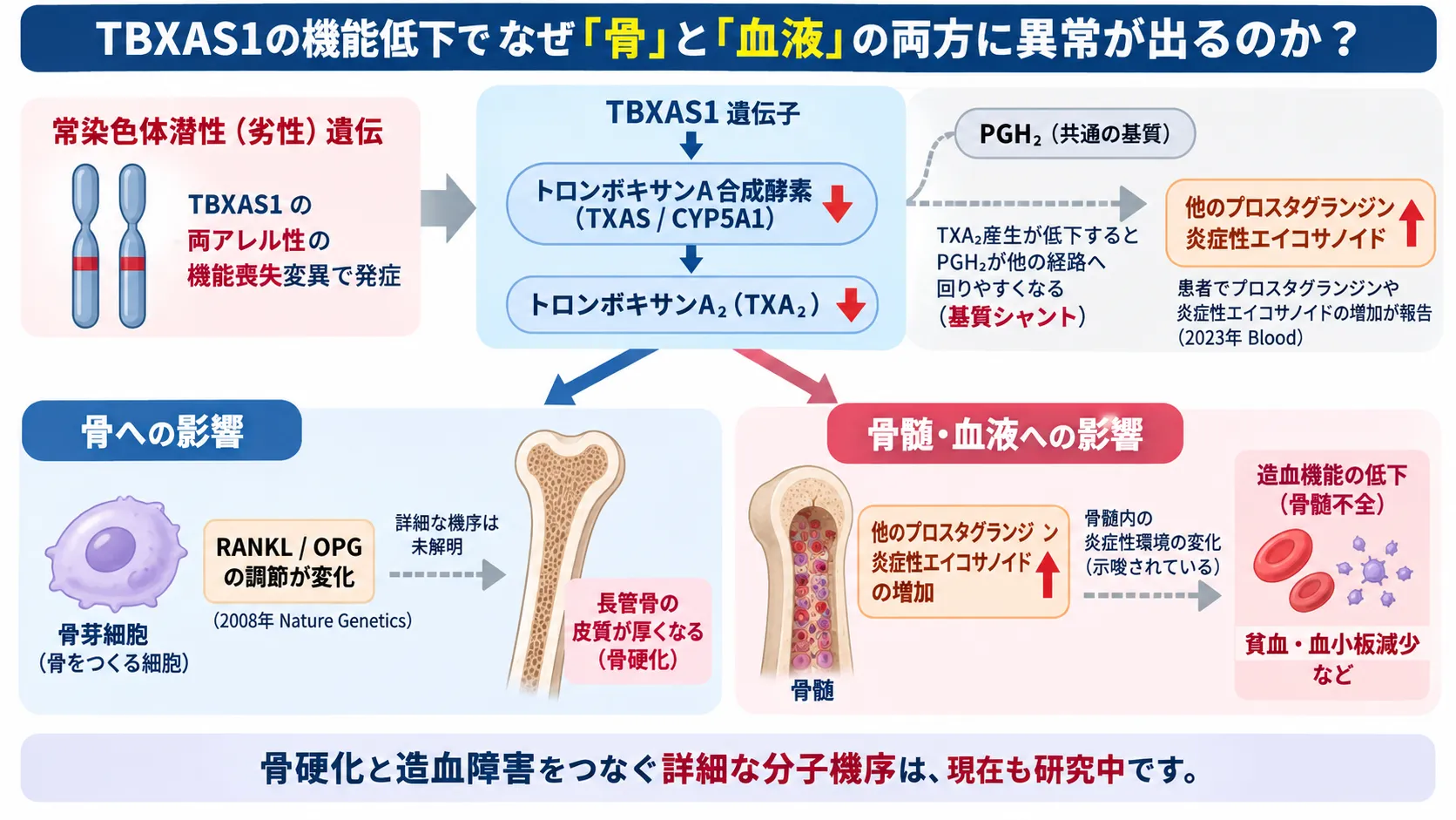 TBXAS1の両アレル性機能喪失によりトロンボキサン合成酵素とTXA2が低下し、プロスタノイド経路の変化を介して長管骨の骨硬化と骨髄不全による貧血・血小板減少につながるGhosal血液骨幹異形成症の発症機序を示す模式図