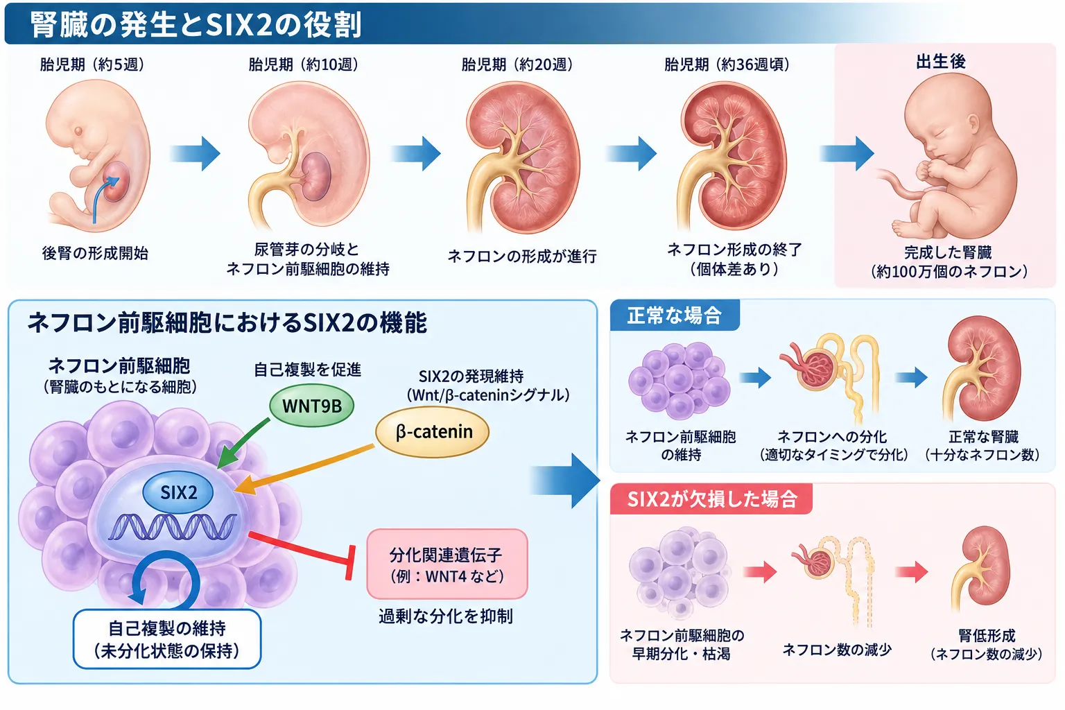 SIX2によるネフロン前駆細胞の維持と腎発生、SIX2欠損による早期分化・ネフロン数減少・腎低形成を示す模式図