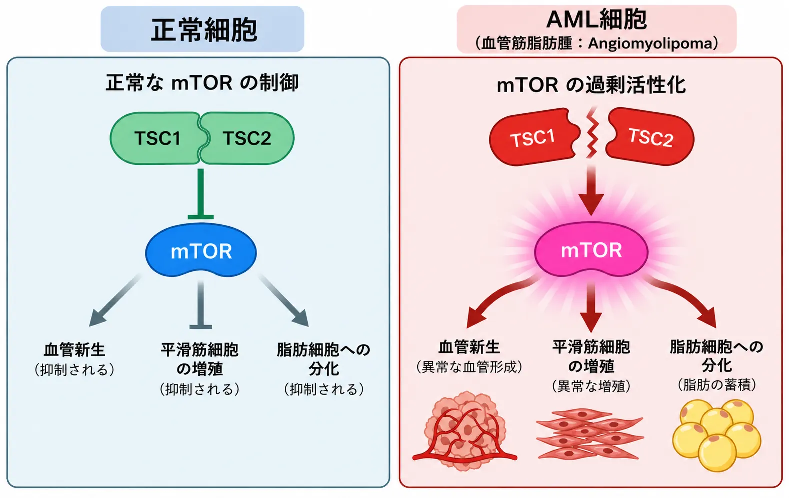 正常細胞とAML(血管筋脂肪腫)細胞におけるmTOR経路の比較図。正常細胞ではTSC1とTSC2が複合体を作りmTORを抑制し、血管新生・平滑筋細胞の増殖・脂肪細胞への分化が抑えられている。AML細胞ではTSC1/TSC2複合体が機能を失いmTORが過剰活性化し、異常な血管形成・平滑筋細胞の異常増殖・脂肪細胞への分化と脂質の蓄積が起こる。