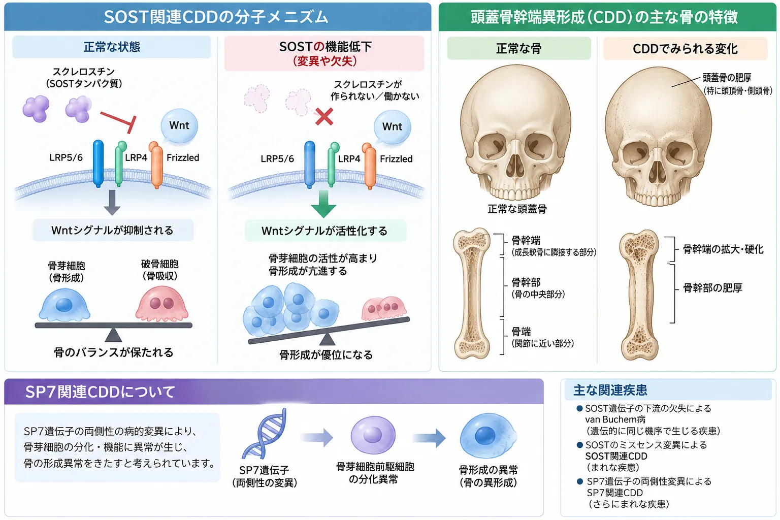 頭蓋骨幹異形成症(CDD)におけるSOST遺伝子異常によるスクレロスチン・Wntシグナル制御の変化、頭蓋骨と長管骨の骨過形成、SP7遺伝子異常による骨芽細胞分化障害を示す模式図