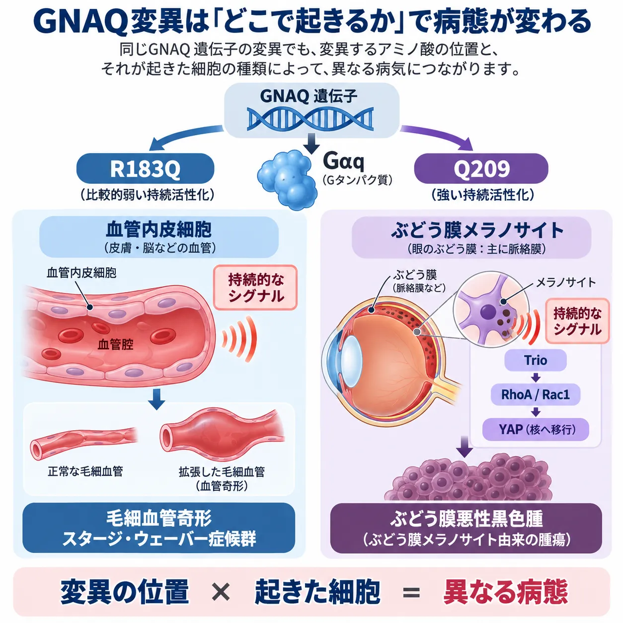 GNAQ変異の位置と細胞種による発症機序の違い|R183QとQ209 GNAQのR183Q変異が血管内皮細胞で毛細血管奇形やスタージ・ウェーバー症候群につながる経路と、Q209変異がぶどう膜メラノサイトでTrio・RhoA/Rac1・YAP経路を活性化し、ぶどう膜悪性黒色腫につながる違いを比較した模式図