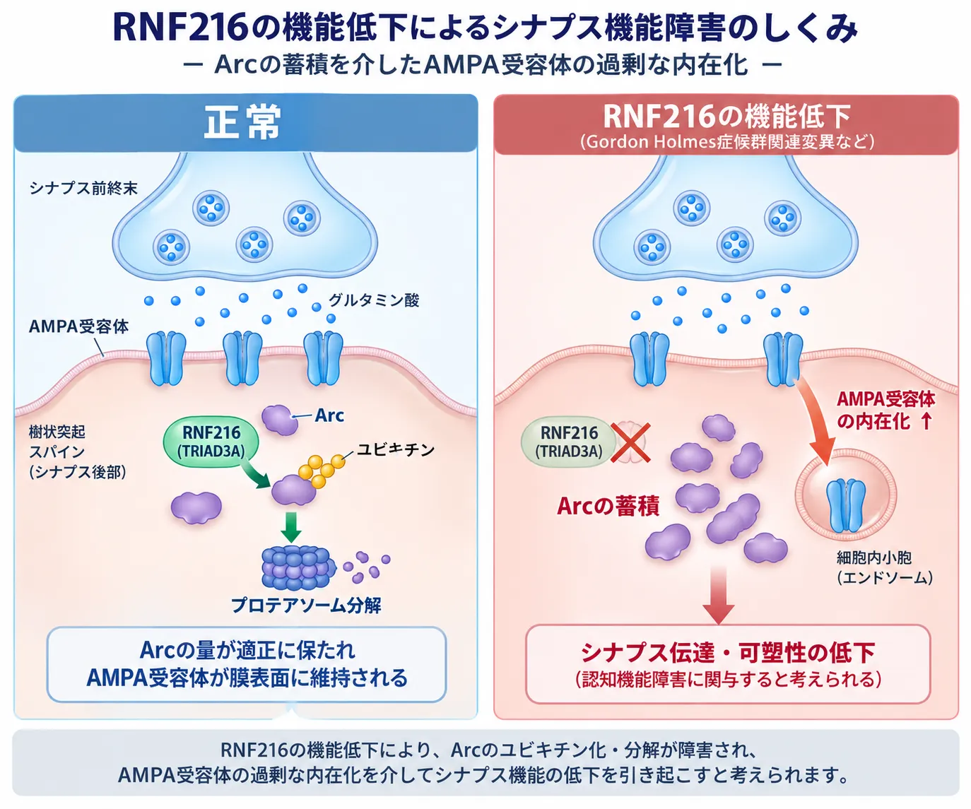 RNF216機能低下によりArcのユビキチン化・分解が障害され、Arc蓄積とAMPA受容体の過剰な内在化を介してシナプス伝達・可塑性が低下する仕組みを正常状態と比較した模式図