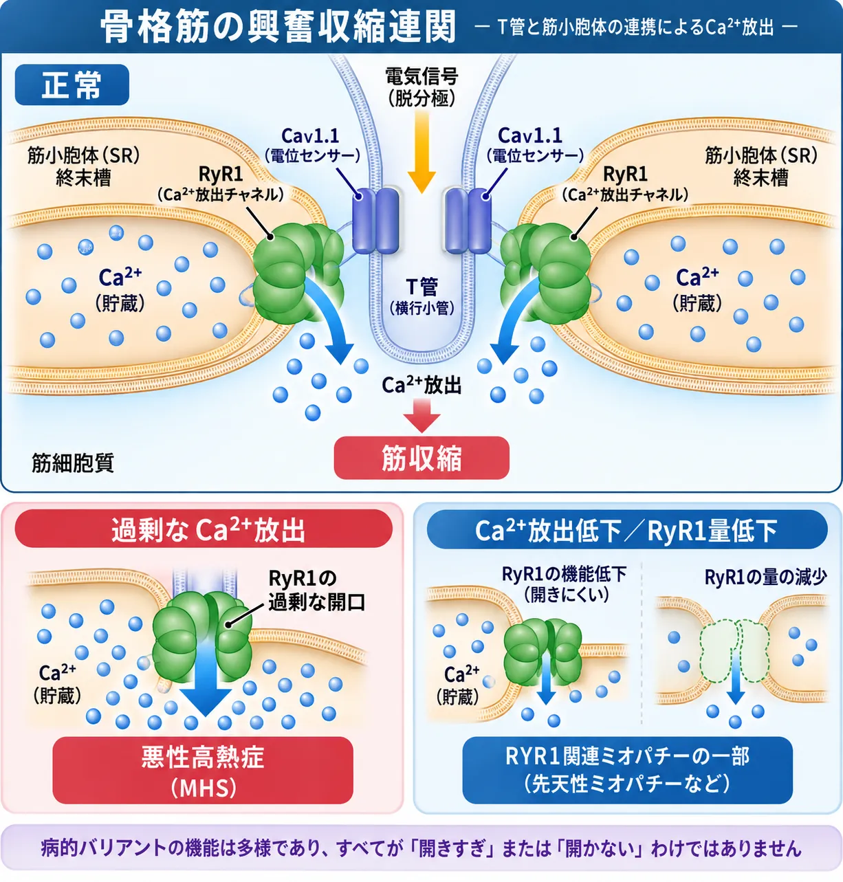骨格筋の興奮収縮連関でCav1.1からRyR1へ信号が伝わり筋小胞体からCa²⁺が放出される正常状態と、RyR1の過剰な開口による悪性高熱症、Ca²⁺放出低下やRyR1量低下によるRYR1関連ミオパチーの発症機序を比較した模式図