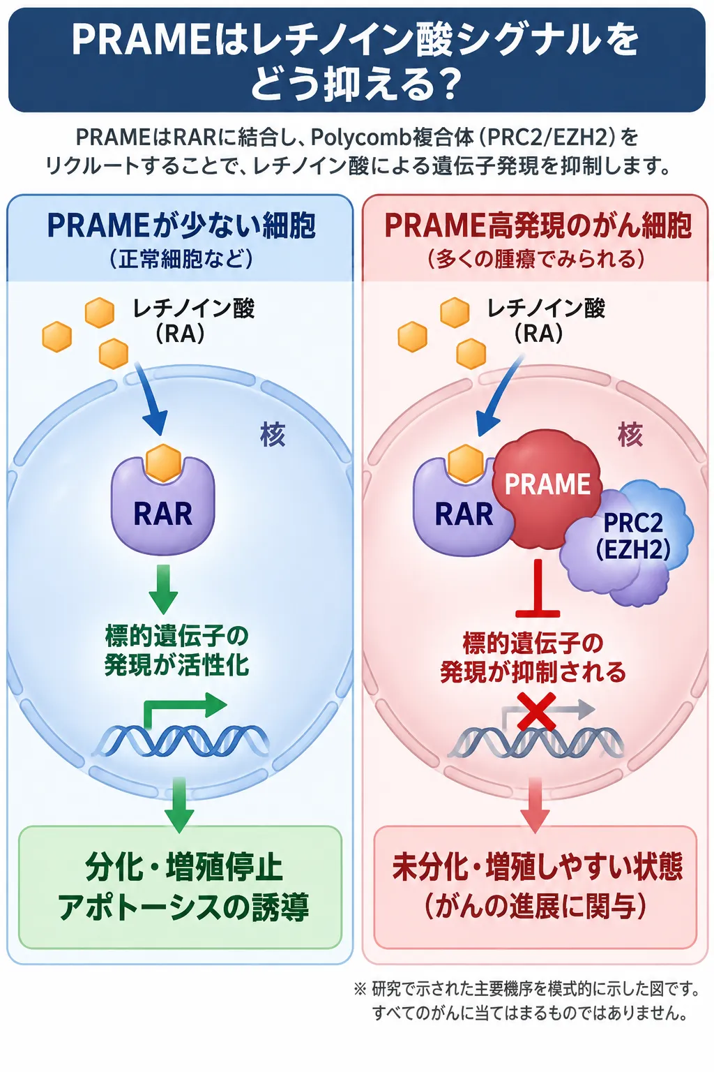 PRAME高発現がレチノイン酸受容体（RAR）シグナルを抑制し、PRC2・EZH2を介して標的遺伝子の発現を抑えることで、がん細胞の未分化・増殖しやすい状態に関与する仕組みを比較した模式図