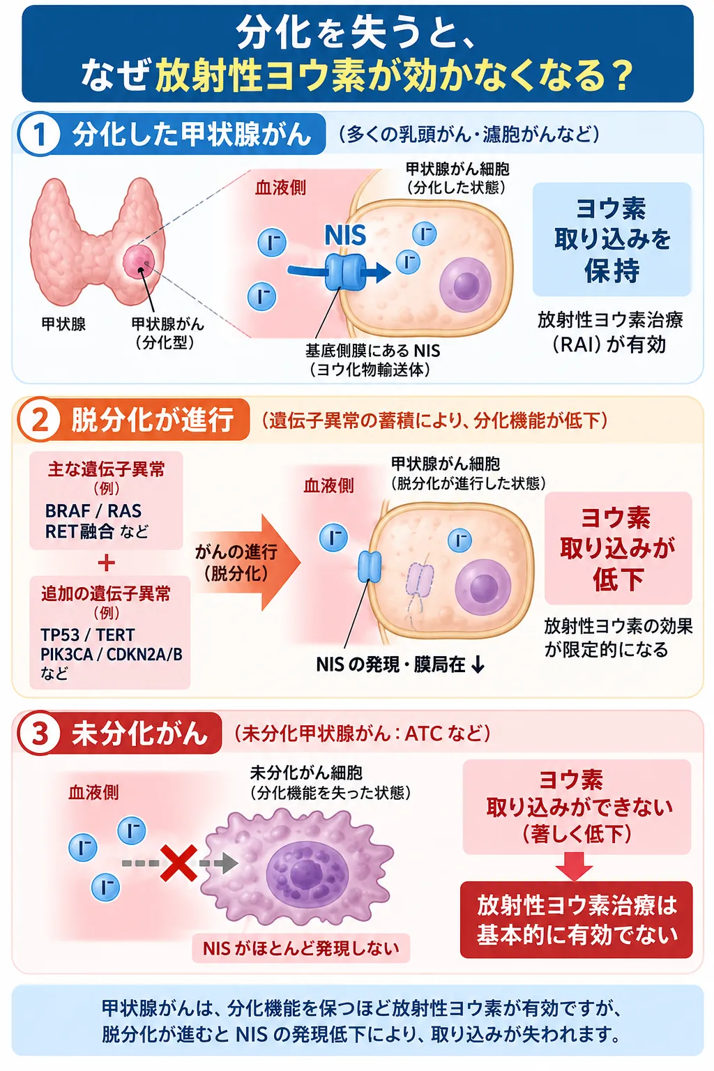 甲状腺がんで分化が保たれているとNISによるヨウ素取り込みが維持される一方、脱分化に伴う遺伝子異常の蓄積でNIS発現が低下し、未分化がんでは放射性ヨウ素治療が基本的に無効となる仕組みを示す模式図