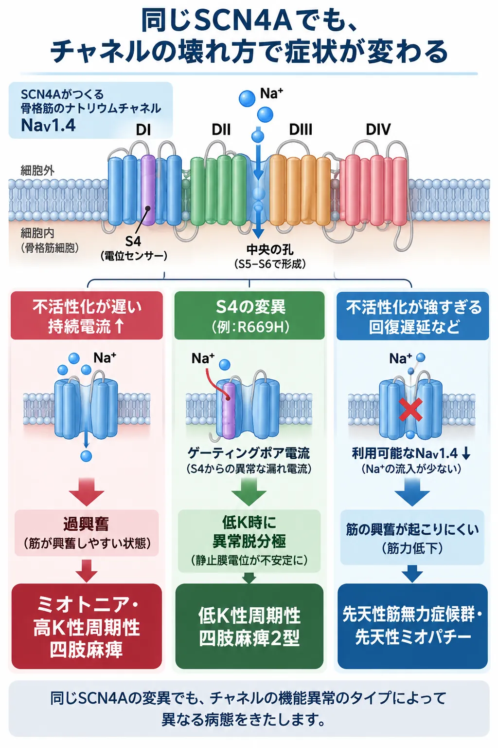 SCN4A・NaV1.4の機能異常とミオトニア・周期性四肢麻痺・筋無力症候群の発症機序 SCN4A遺伝子がコードする骨格筋ナトリウムチャネルNaV1.4で、不活性化遅延による持続電流がミオトニア・高カリウム性周期性四肢麻痺、S4電圧センサー変異によるゲーティングポア電流が低カリウム性周期性四肢麻痺2型、過剰な不活性化や回復遅延が先天性筋無力症候群・先天性ミオパチーにつながる仕組みを比較した模式図
