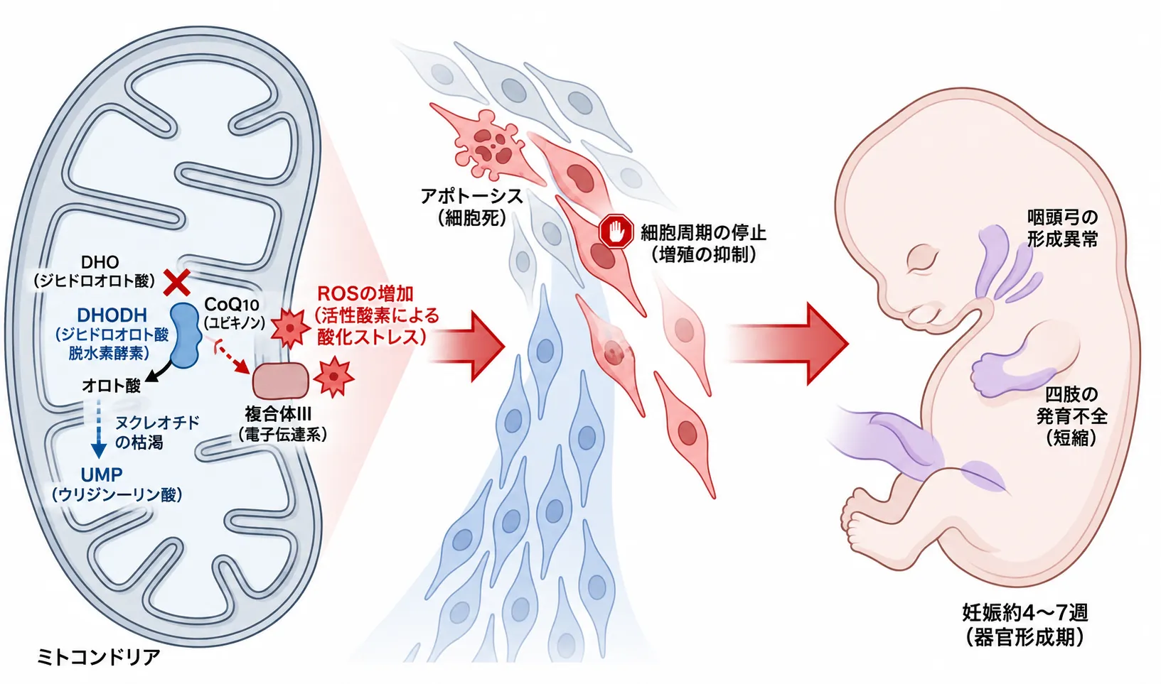 ミラー症候群の病態仮説を示す3段階の模式図。左：DHODH機能低下によるピリミジン新規合成低下と、ミトコンドリア内膜でのCoQを介した反応との関連。中央：発生期の細胞増殖・分化への影響を示し、ROS蓄積や細胞死への関与は研究上の仮説を含む。右：受精後4〜7週ごろの咽頭弓と肢芽の発生への影響を示す。DHODH機能低下が顔面骨と四肢形成異常につながる詳細機序には未解明の部分がある。