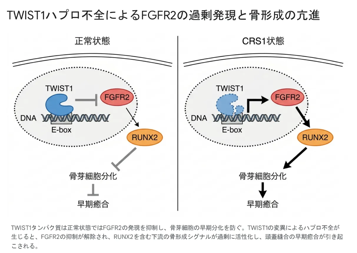 正常状態とCRS1状態を左右で比較した、TWIST1ハプロ不全による骨形成亢進のメカニズム図。正常状態では、DNAのE-boxに結合したTWIST1タンパク質がFGFR2の発現を抑制し、RUNX2を介した骨芽細胞分化と頭蓋縫合の早期癒合を抑えている。CRS1状態では、TWIST1のはたらきが半分になる(ハプロ不全)ことで、FGFR2の抑制が外れて過剰に発現し、RUNX2を含む下流の骨形成シグナルが活性化して骨芽細胞分化が進み、頭蓋縫合の早期癒合が引き起こされる。