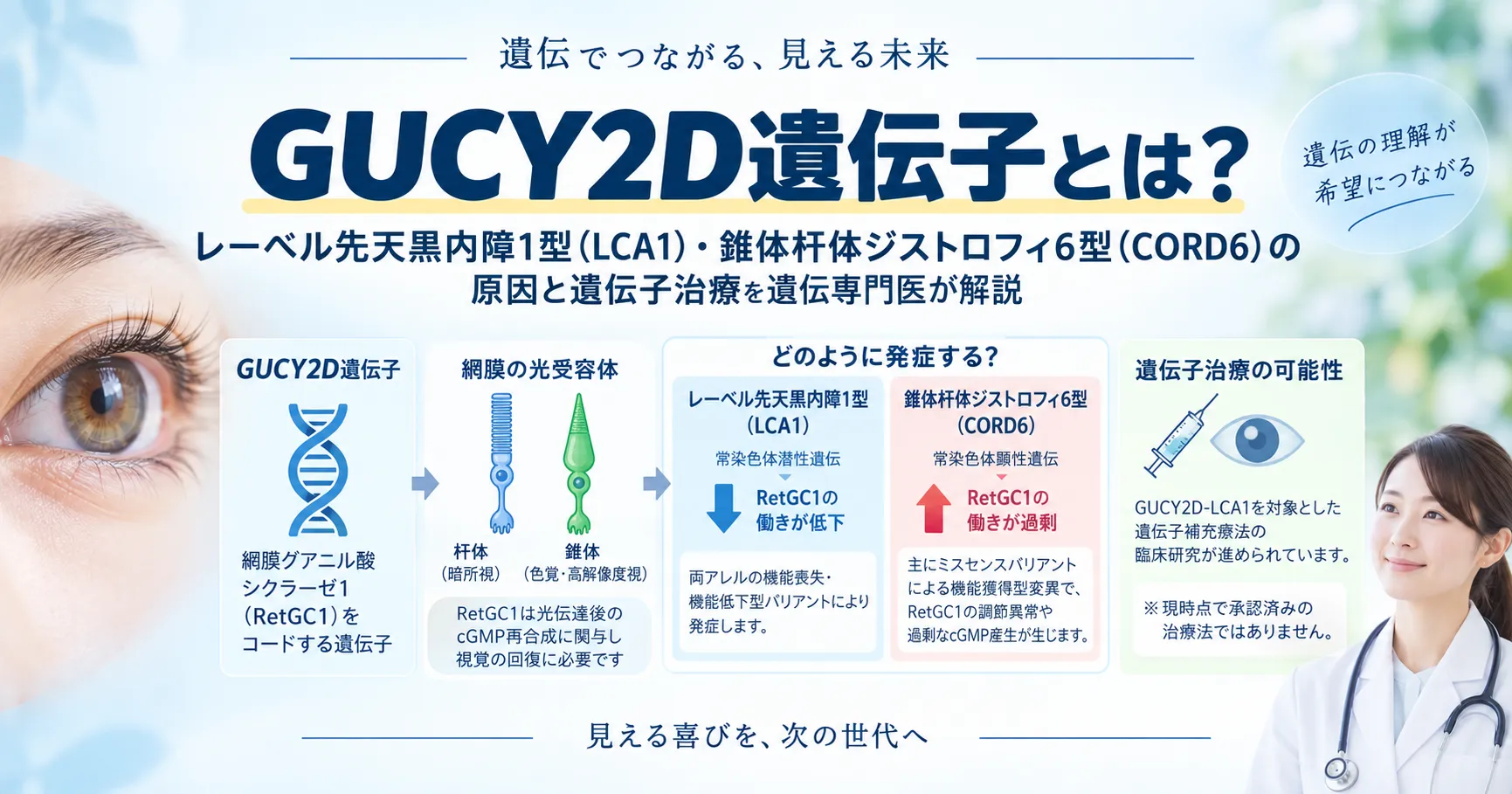 GUCY2D遺伝子の概要を示すインフォグラフィック。網膜グアニル酸シクラーゼ1（RetGC1）をつくる遺伝子で、働きが低下するとレーベル先天黒内障1型（常染色体潜性）、働きが過剰になると錐体杆体ジストロフィ6型（常染色体顕性）を起こすこと、遺伝子補充療法の臨床研究が進んでいることを示した図