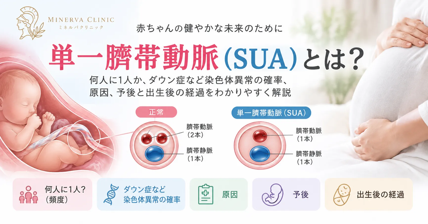 単一臍帯動脈(SUA)の要点 単一臍帯動脈(SUA)の要点:へその緒の動脈が1本、頻度約1%、孤立性か合併異常ありかで評価が分かれる