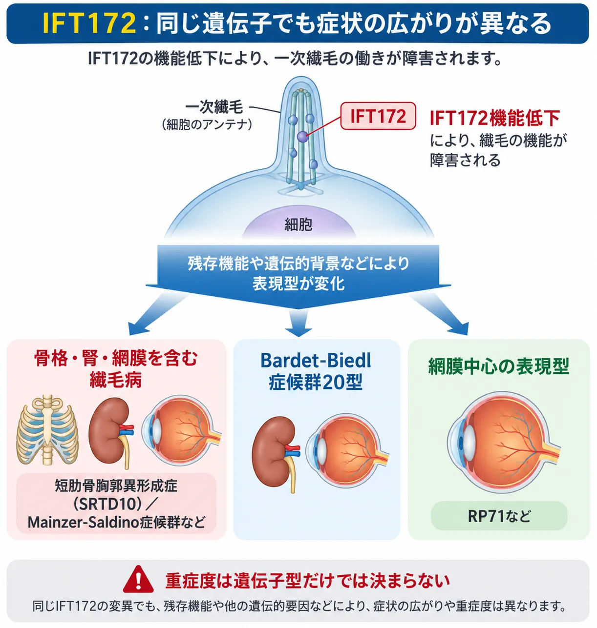 IFT172の機能低下によって一次繊毛の働きが障害され、残存機能や遺伝的背景などの違いにより、短肋骨胸郭異形成症10型などの骨格・腎・網膜を含む繊毛病、バルデー・ビードル症候群20型、網膜色素変性症71型などの網膜中心の表現型へ分かれることを示す模式図