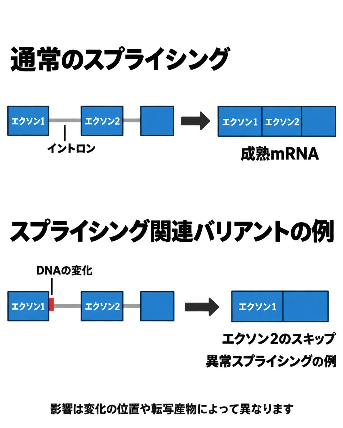 通常のスプライシングと、スプライシング関連バリアントの一例を比較した図。DNAの変化から前駆体RNAの処理に影響が及び、成熟mRNAでエクソン2がスキップされる流れ