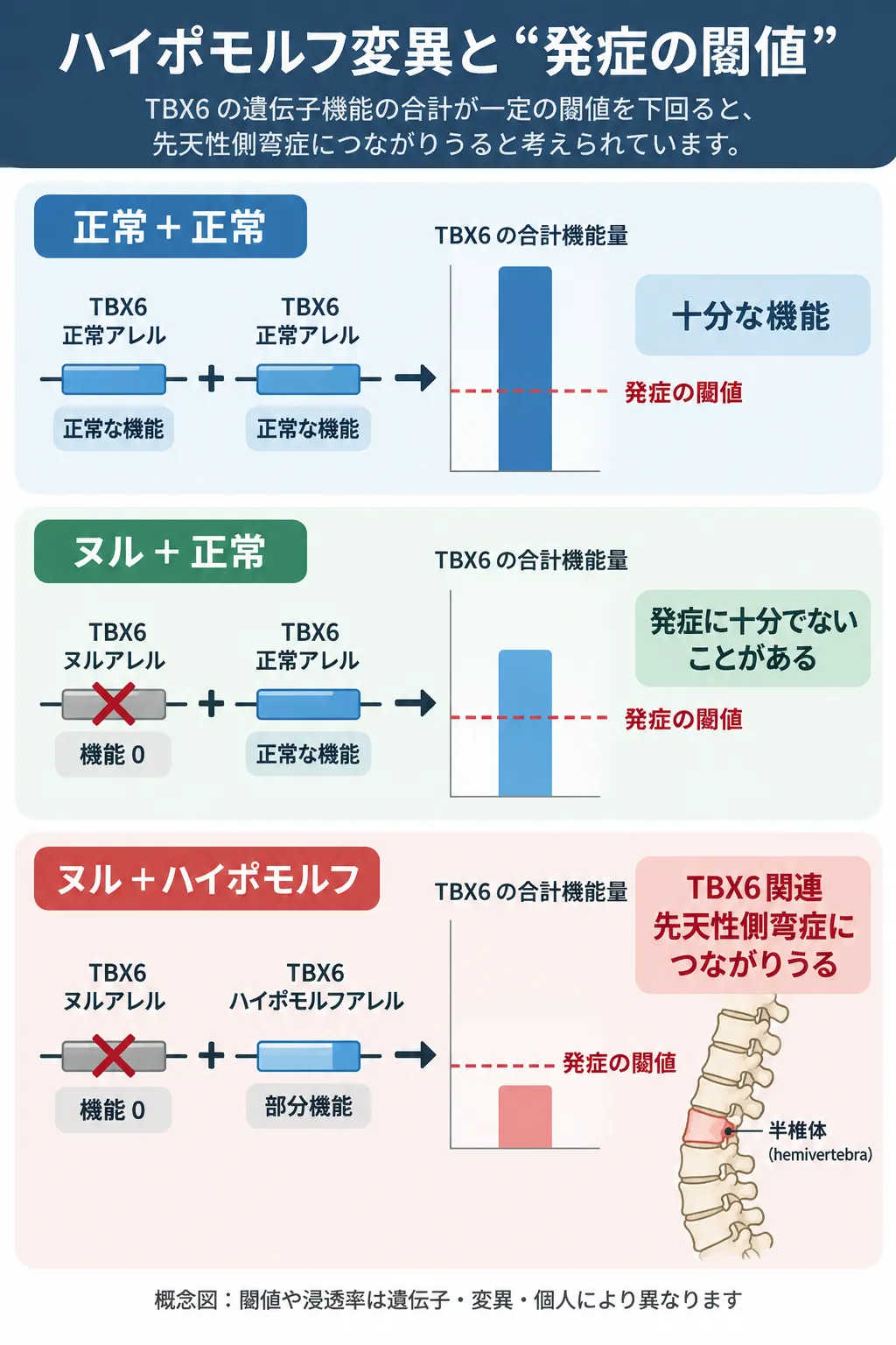 TBX6の正常アレル、ヌルアレル、ハイポモルフアレルの組み合わせによる遺伝子機能量の違いと、発症閾値を下回ることでTBX6関連先天性側弯症につながりうる仕組みを示す模式図