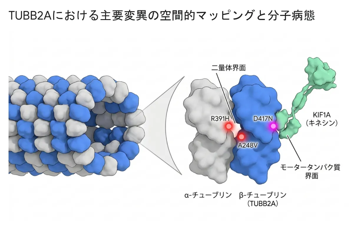 図：TUBB2Aにおける主要変異の空間的マッピングと分子病態微小管を構成するα/β-チューブリン二量体の立体構造上に、R391H（二量体界面）・A248V（二量体内部）・D417N（キネシンKIF1Aとの結合面）の3変異を配置。変異の「場所」が異なることが、病態の違い（脳発達障害／進行性神経変性）に直結します。
