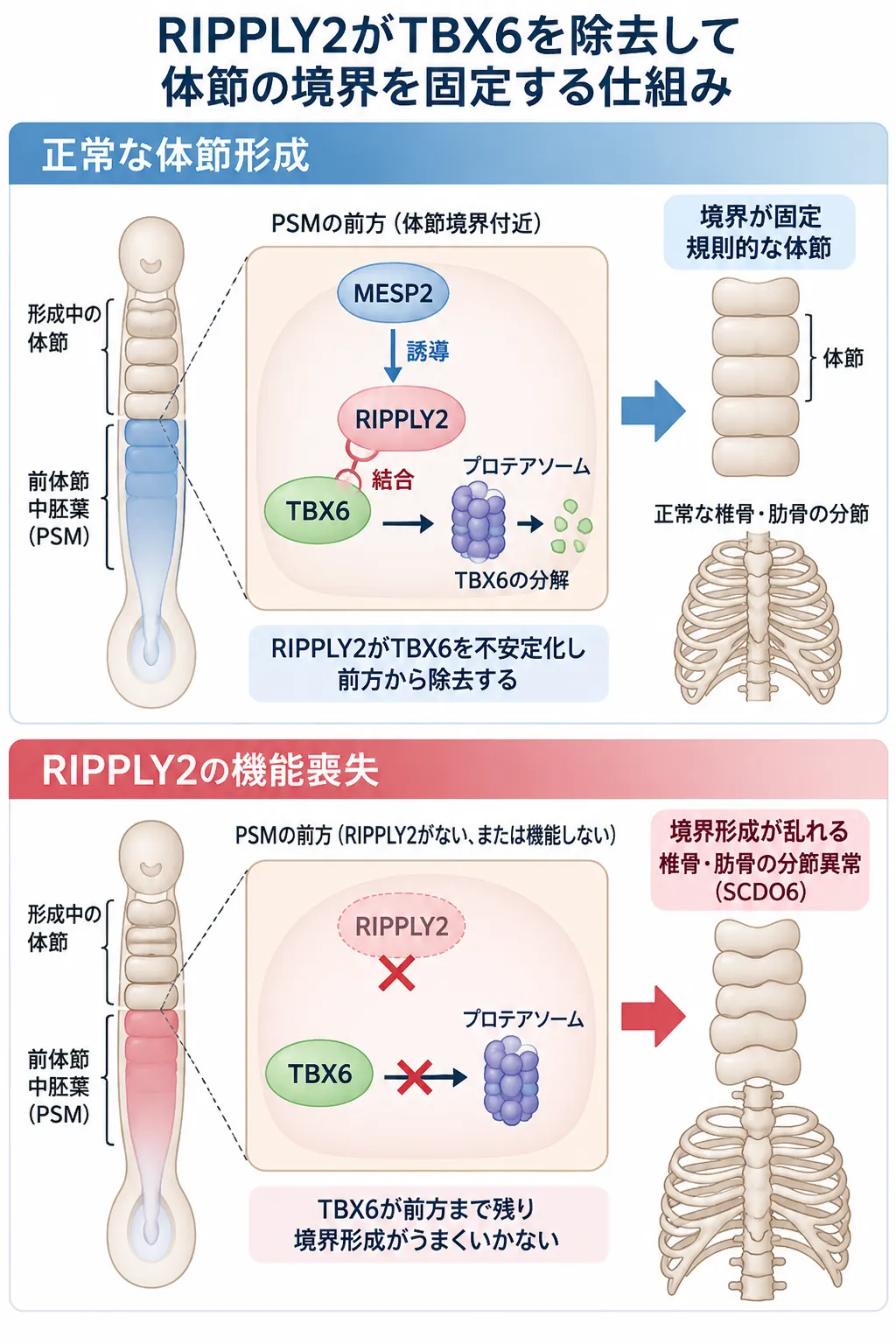 RIPPLY2がTBX6をプロテアソーム依存的に分解して体節境界を形成する正常な仕組みと、RIPPLY2機能喪失によりTBX6の除去が障害され、椎骨・肋骨の分節異常を伴う脊椎肋骨異形成症6型（SCDO6）につながる機序を比較した模式図