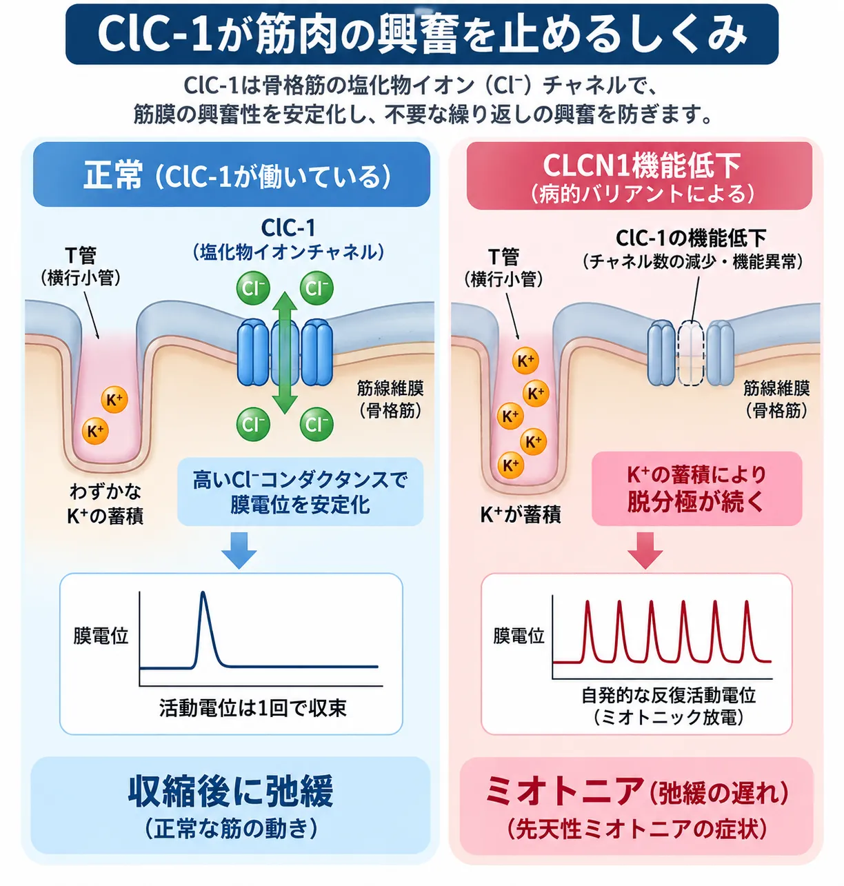 正常な骨格筋ではClC-1クロライドチャネルによる高いCl⁻コンダクタンスが膜電位を安定化する一方、CLCN1病的バリアントによるClC-1機能低下ではT管へのK⁺蓄積に伴う脱分極が持続し、反復活動電位とミオトニア(筋弛緩の遅れ)が生じる仕組みを比較した模式図
