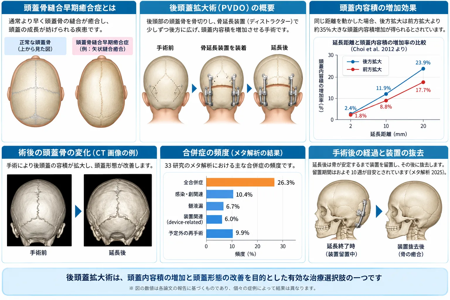 後頭蓋拡大術・後頭蓋骨延長術(PVDO)の仕組みと効果を示す模式図。頭蓋縫合早期癒合症、骨延長装置による後方拡大、頭蓋内容積の増加、合併症の頻度、装置抜去までの経過を示している。