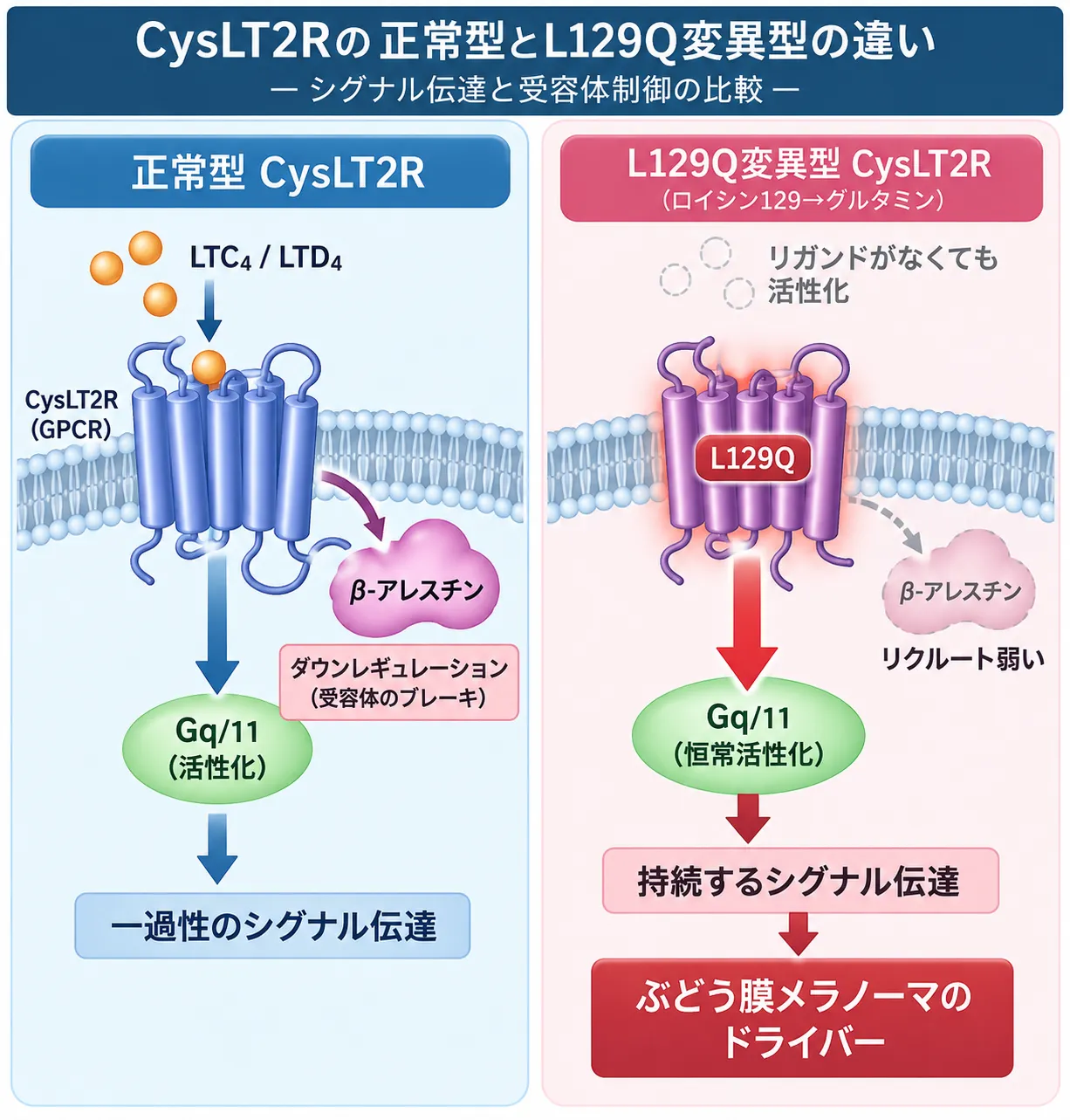 正常なCysLT2RではLTC4・LTD4の結合によりGq/11シグナルが一過性に活性化し、βアレスチンによる受容体の脱感作・ダウンレギュレーションが働く一方、L129Q変異型CysLT2Rではリガンド非依存的なGq/11シグナルが持続し、βアレスチンのリクルートが弱く、ぶどう膜メラノーマのドライバーとなる仕組みを比較した模式図