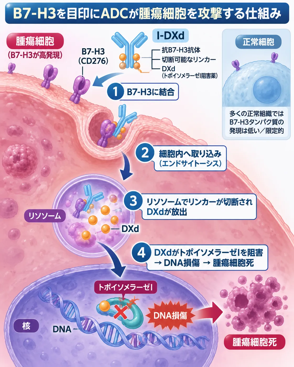 B7-H3（CD276）が高発現する腫瘍細胞に抗体薬物複合体イフィナタマブ デルクステカン（I-DXd）が結合し、細胞内へ取り込まれた後にDXdを放出してトポイソメラーゼIを阻害し、DNA損傷と腫瘍細胞死を引き起こす仕組みを示す模式図