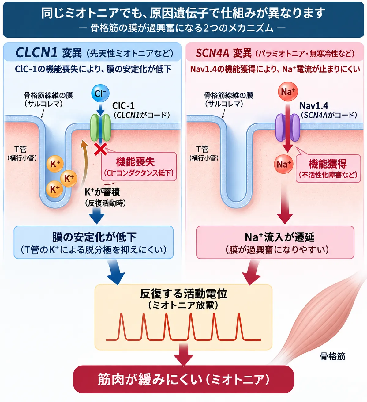 非ジストロフィー性ミオトニアで、CLCN1機能喪失によるClC-1塩化物コンダクタンス低下と、SCN4A機能獲得によるNav1.4ナトリウム電流の遷延が、反復する活動電位と筋肉の弛緩遅延につながる仕組みを比較した模式図
