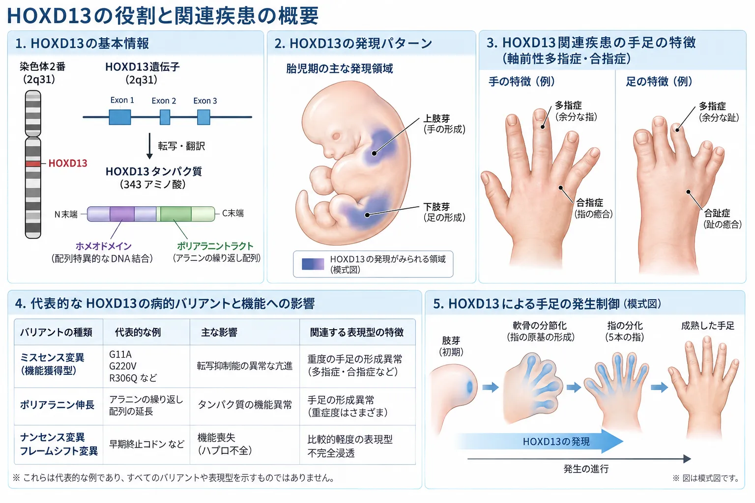HOXD13遺伝子の役割と関連疾患を示す医学イラスト。2q31の遺伝子位置、HOXD13タンパク質のホメオドメインとポリアラニントラクト、胎児期の四肢での発現、合多指趾症・合指症などの手足の特徴、病的バリアントと四肢発生への影響を示す