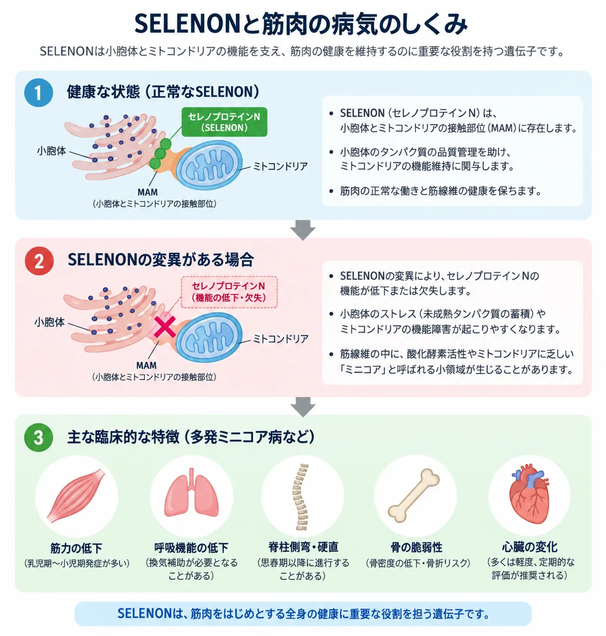 SELENON遺伝子の機能低下から筋力低下・呼吸機能低下・脊柱側弯などが生じる仕組み