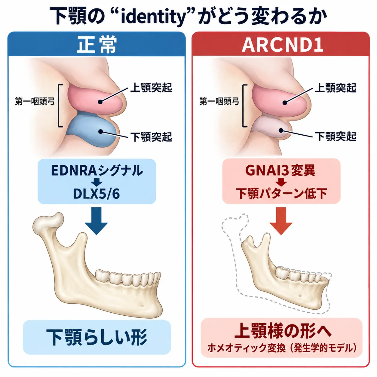 正常ではEDNRAシグナルを介してDLX5・DLX6が下顎の形成を促す一方、耳介下顎症候群1型(ARCND1)ではGNAI3変異により下顎のパターン形成が障害され、下顎が上顎様の形態へ変化するホメオティック変換を比較した模式図