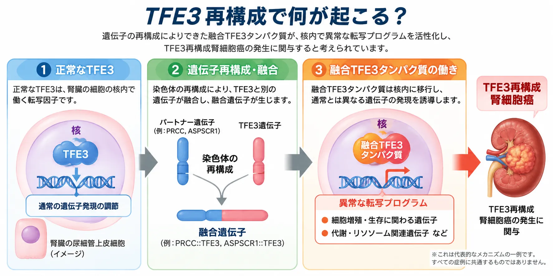 TFE3遺伝子が染色体再構成によってPRCCやASPSCR1などのパートナー遺伝子と融合し、融合TFE3タンパク質による異常な転写プログラムを介してTFE3再構成腎細胞癌の発生に関与する仕組みを示す模式図