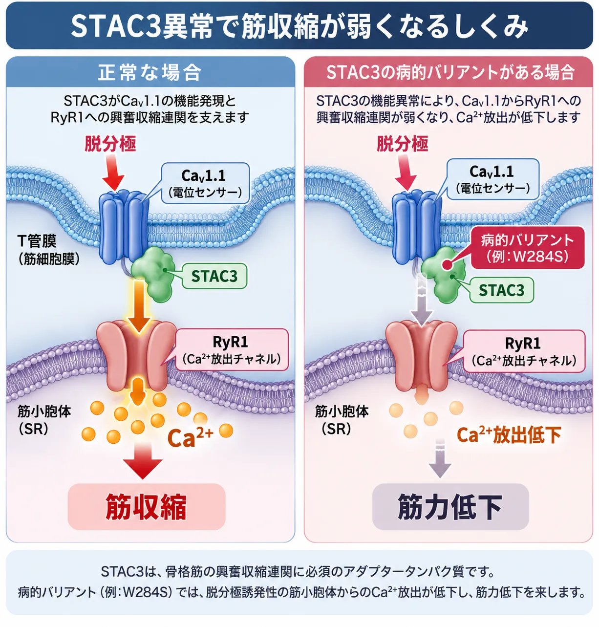 正常な骨格筋ではSTAC3がCaV1.1とRyR1を介した興奮収縮連関を支え、筋小胞体からCa²⁺が放出されて筋収縮が起こる一方、STAC3病的バリアントではCa²⁺放出が低下して筋力低下につながる仕組みを比較した模式図