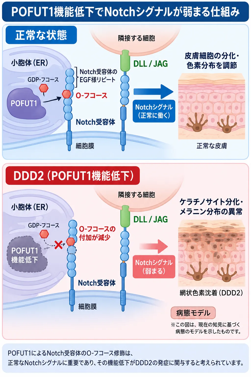 POFUT1によるNotch受容体のO-フコース修飾が正常なNotchシグナルを支える状態と、POFUT1機能低下によりO-フコース修飾とNotchシグナルが低下し、DDD2の網状色素沈着につながる病態モデルを比較した模式図