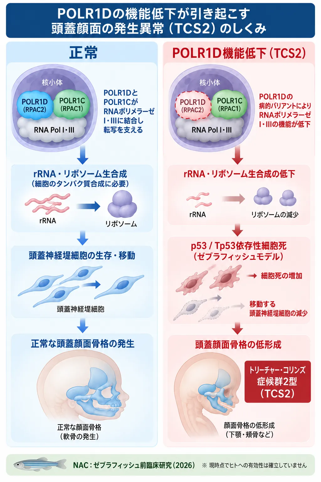 POLR1D機能低下によりRNAポリメラーゼI・IIIの機能とrRNA・リボソーム生合成が低下し、頭蓋神経堤細胞の減少を介してトリーチャー・コリンズ症候群2型の頭蓋顔面低形成につながる発症機序を正常と比較した模式図