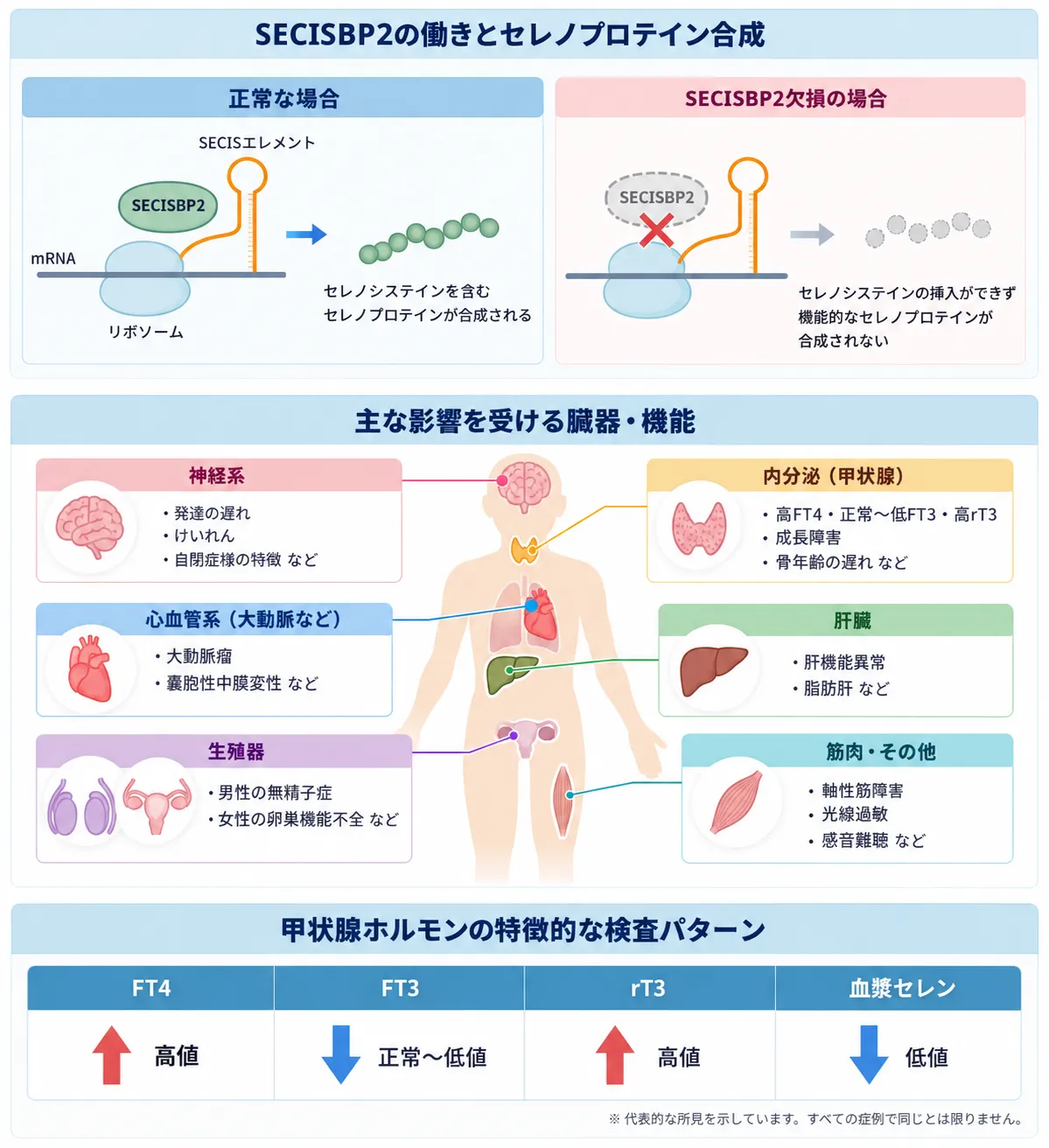 SECISBP2欠損によるセレノプロテイン合成障害と全身への影響、特徴的な甲状腺ホルモン検査パターンを示す図